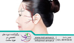 Vessels effective in bleeding at the thread entry point in the lift | عروق موثر در خونریزی درمحل ورود نخ