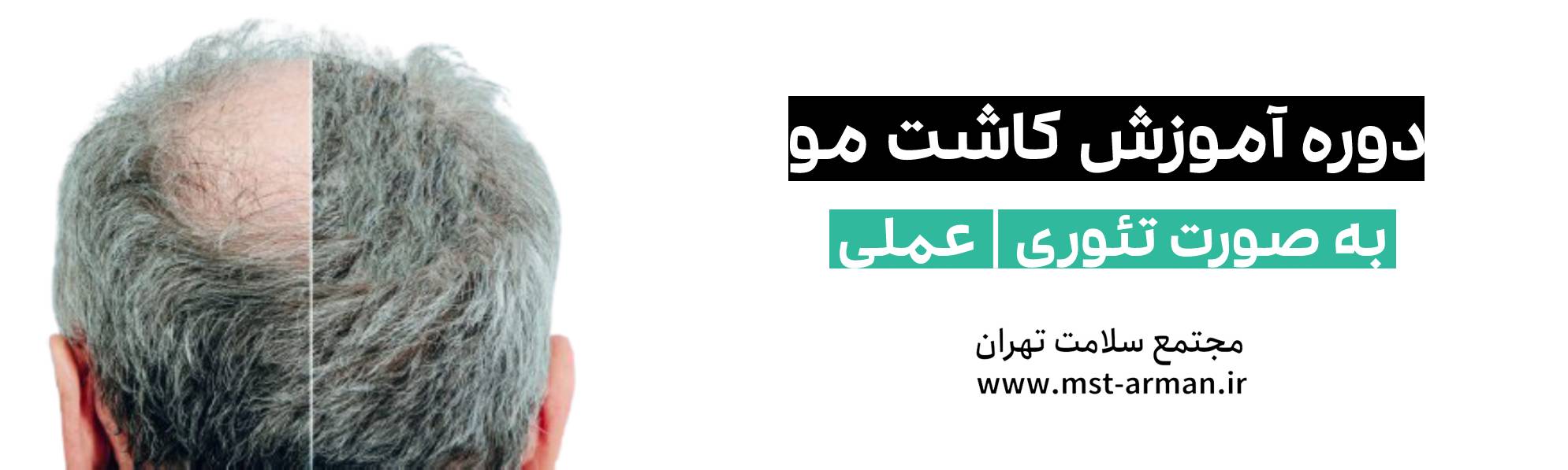 دوره کاشت مو