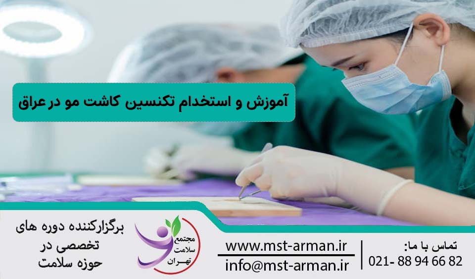 استخدام تکنسین کاشت مو در عراق