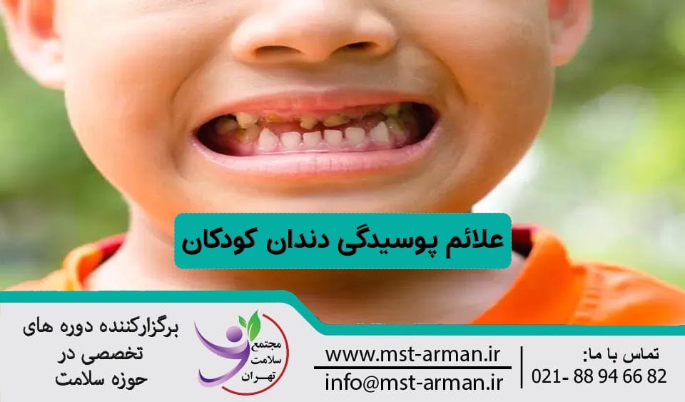 علائم پوسیدگی دندان کودک