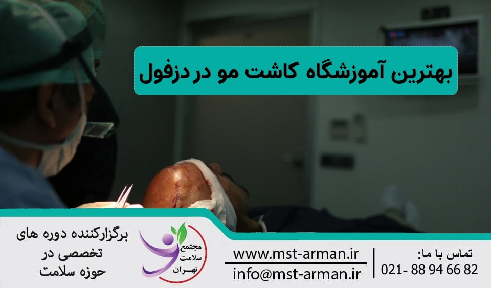 آموزشگاه کاشت مو در دزفول