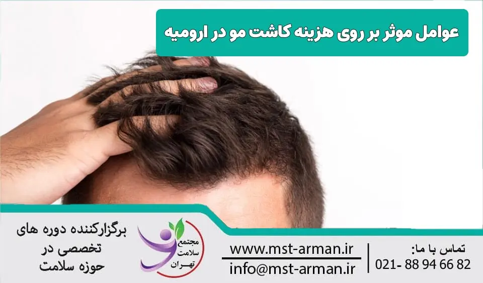 عوامل موثر بر روی هزینه کاشت مو ارومیه