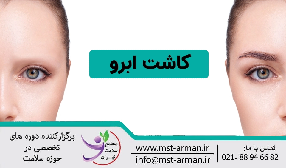 کاشت ابرو