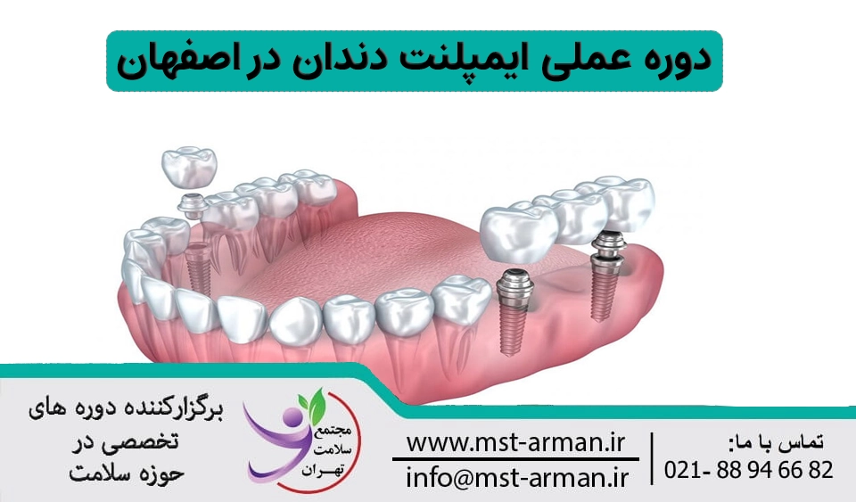 دوره عملی ایمپلنت دندان اصفهان