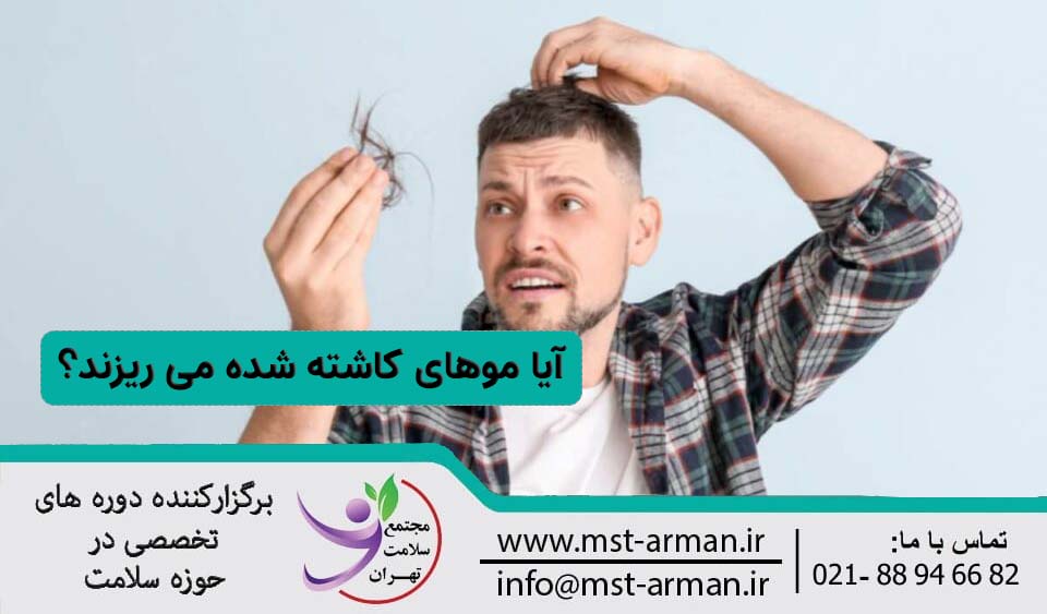 موهای کاشته شده می ریزند؟