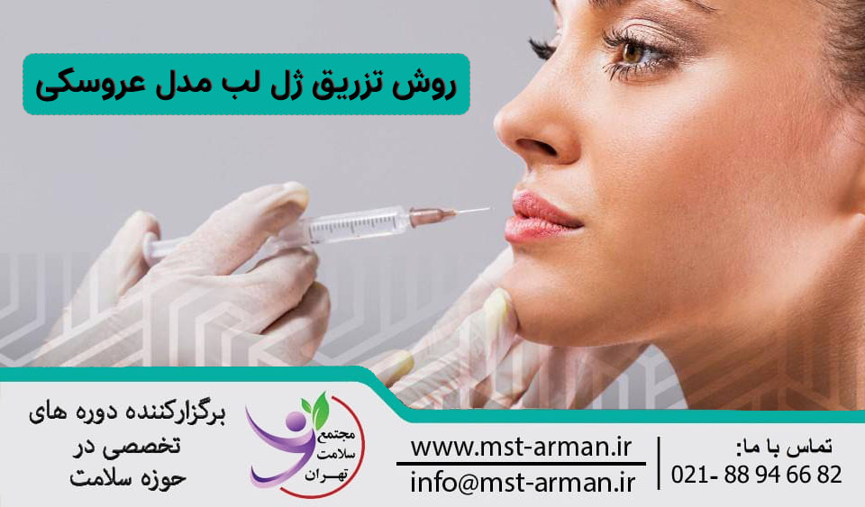 روش تزریق ژل لب عروسکی