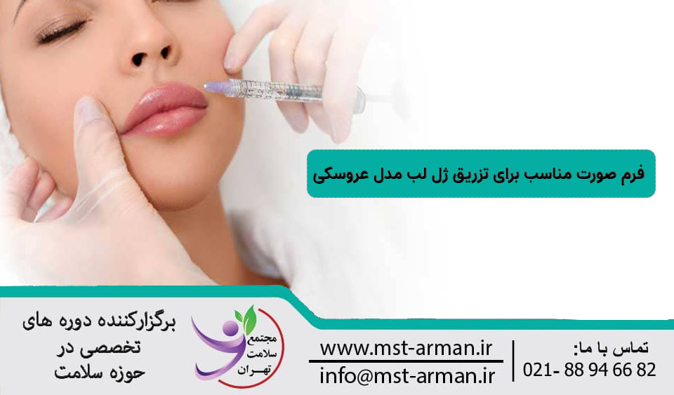 فرم صورت مناسب تزریق ژل لب مدل عروسکی