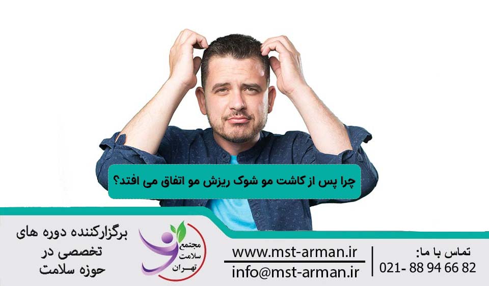 شوک ریزش مو بعد از کاشت مو
