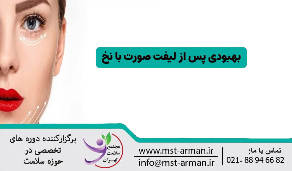 بهبودی پس از لیفت با نخ