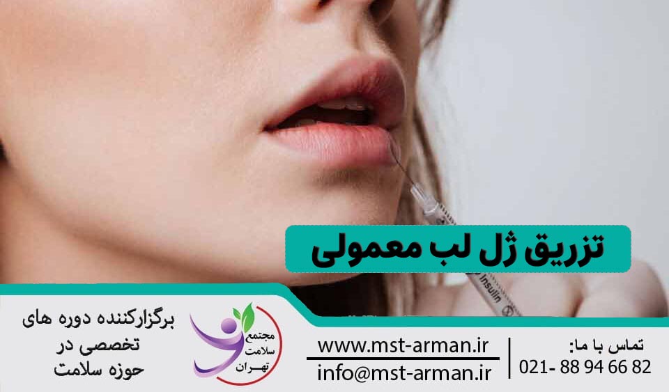 ژل لب معمولی