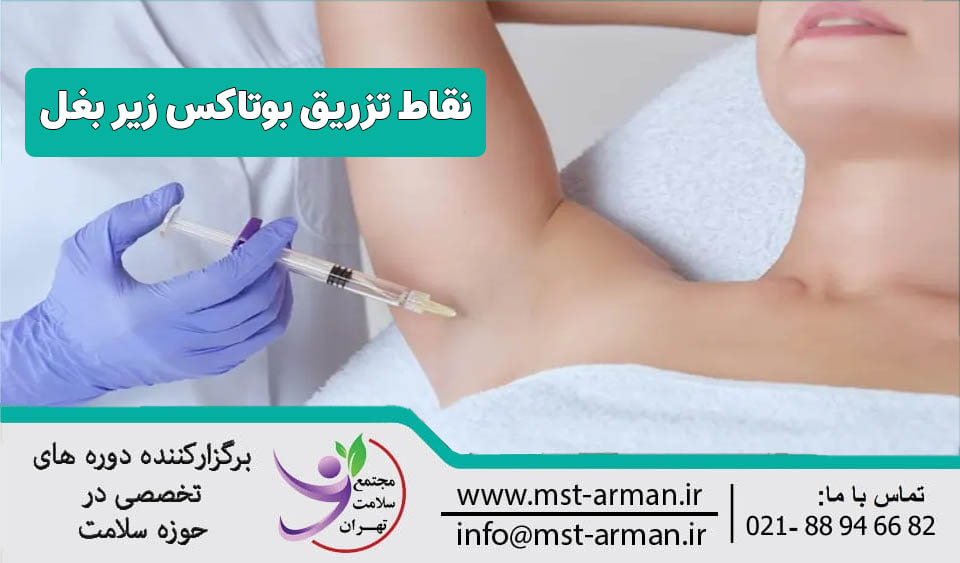 نقاط تزریق بوتاکس زیر بغل