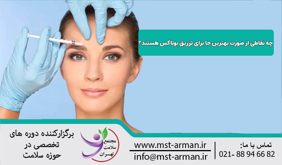 بهترین نقاط تزریق بوتاکس صورت