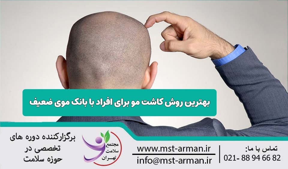 آیا کاشت مو با بانک موی دیگران امکان پذیر است؟