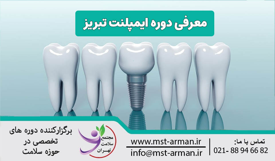 دوره ایمپلنت دندان در تبریز