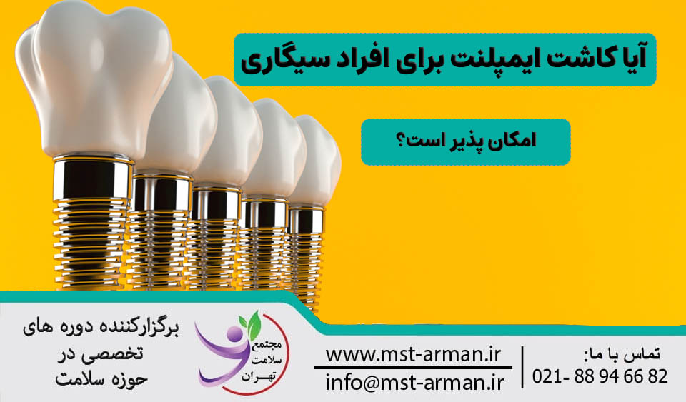 آیا کاشت ایمپلنت برای افراد سیگاری امکان پذیر است؟