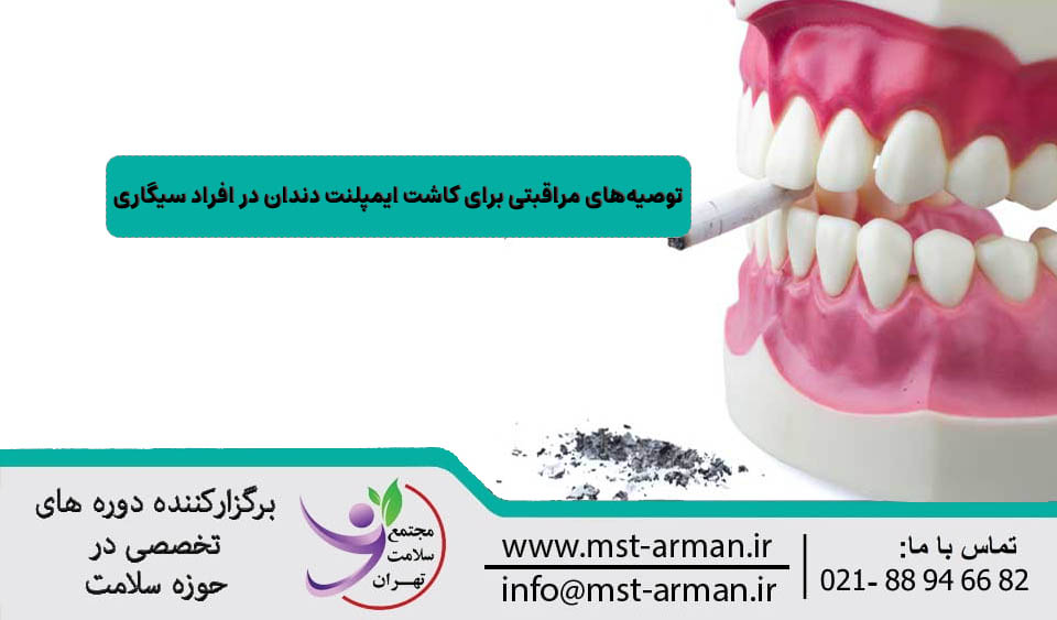توصیه‌های مراقبتی برای کاشت ایمپلنت دندان در افراد سیگاری