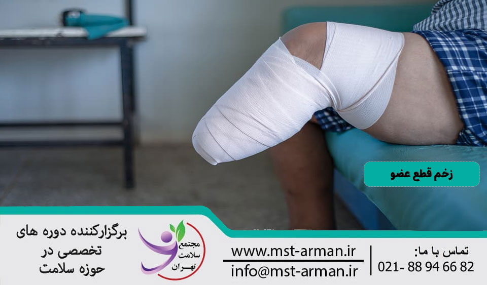 زخم قطع عضو
