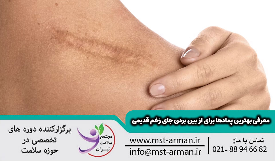 معرفی بهترین پمادها برای از بین بردن جای زخم قدیمی